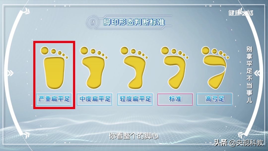 腰疼引起腿和脚麻是怎么回事,经常腰痛原来是脚的问题