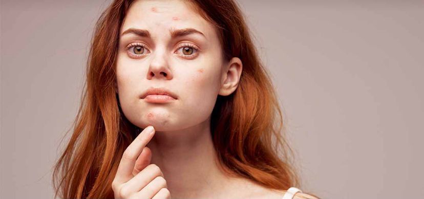 长痘留下的疤能消除吗,长痘留下的毛孔真的恢复不了了吗