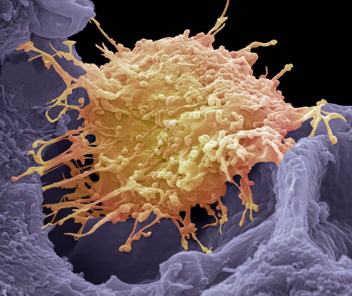 hpv的高危型有哪几种,hpv高危分型是什么意思