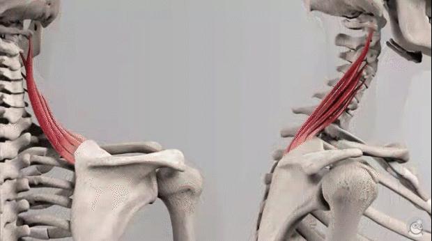 走路高低肩怎么矫正,高低肩怎么自我矫正