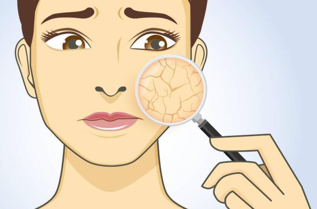 身体皮肤干燥起皮用什么方法补水,秋天皮肤干燥起皮用什么方法