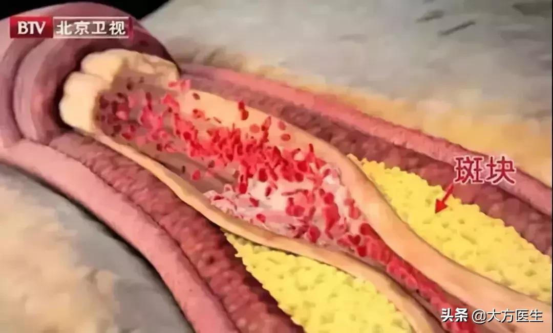 饼干吃多了也会致癌吗？怎样食用更安全？