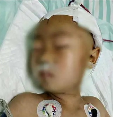 孩子从电瓶车后座掉下来磕到头,儿童从电瓶车摔下来严重吗