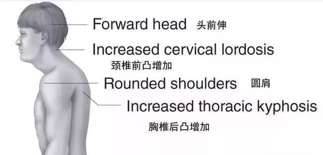脖子后面颈椎有个鼓包怎么办,颈椎大包怎样通过锻炼来恢复