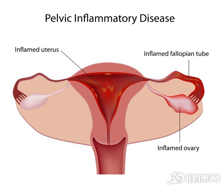 经常腰疼是不是肾虚的表现,女人腰疼是肾虚的表现吗