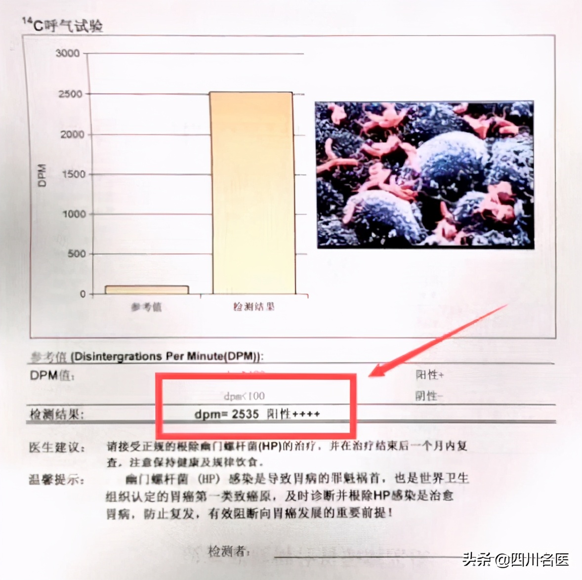 口臭的原因和快速解决方案,很严重的口臭为什么找不到原因