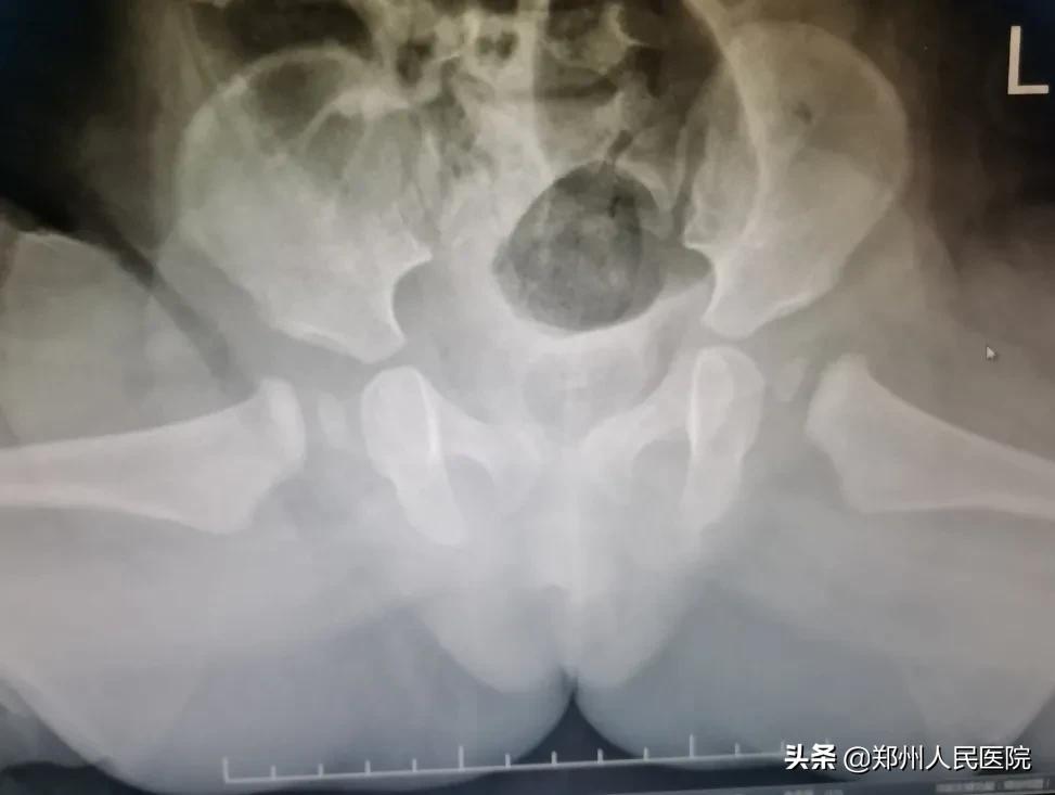 走路像鸭子一样摇摆,走路像鸭子的样子