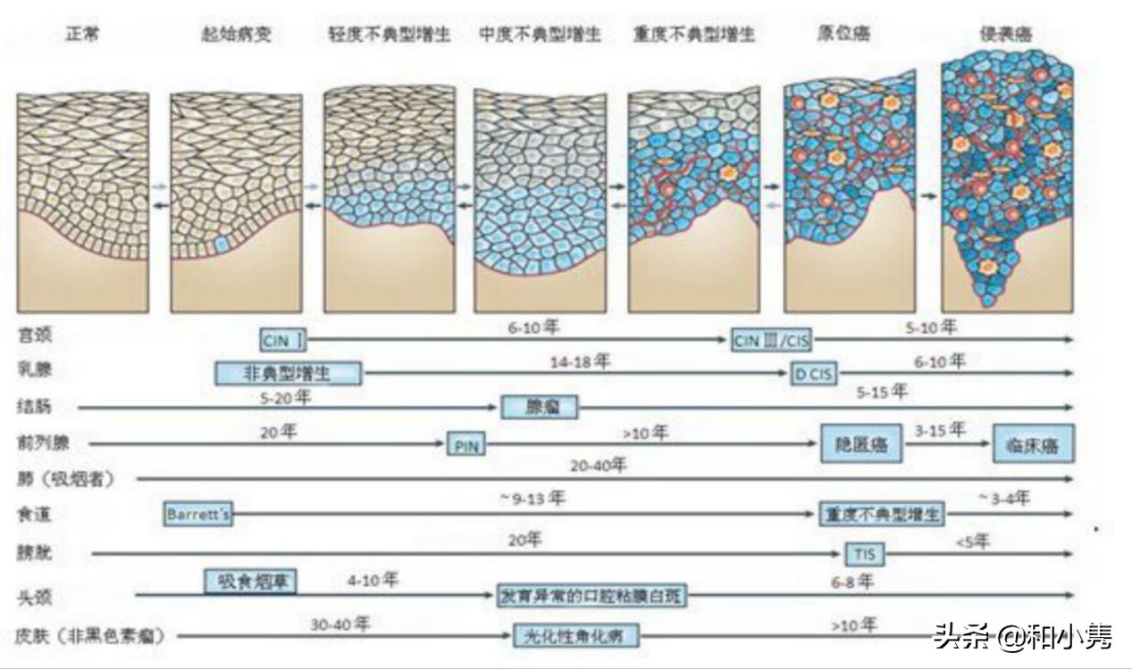 保险公司买重大疾病保险值得买吗,大疾病保险买哪种保险