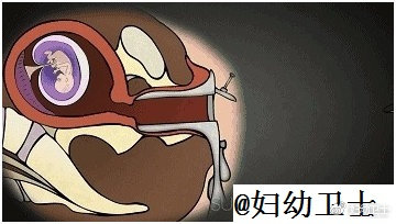 人流对生育影响有多大,人流不干净二次清宫影响怀孕吗