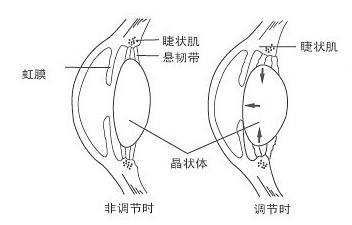 高度近视眼1000度视频,高度近视1000度会瞎吗