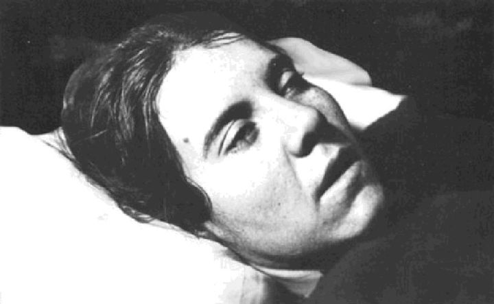 绁炵鏄忕潯鐥呯殑鐪熺浉,绁炵鐨勯粦姝荤梾娑堝け涔嬭皽