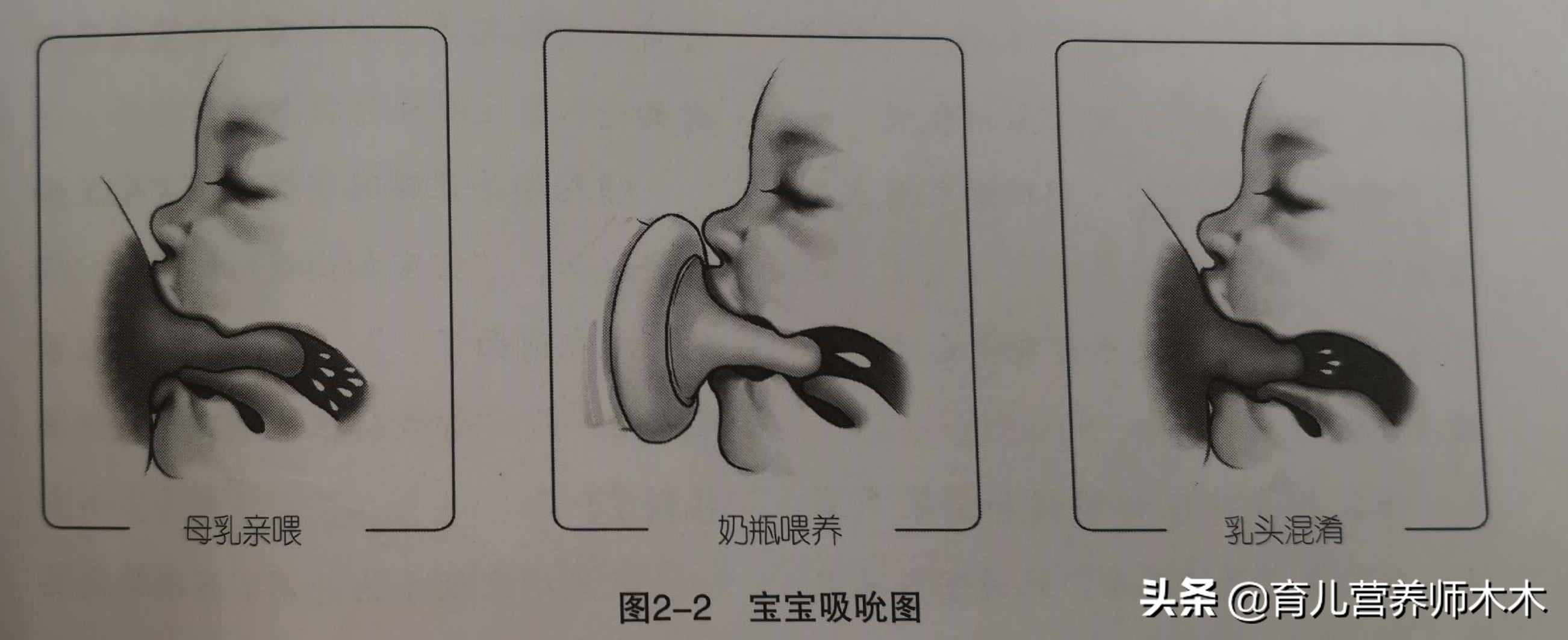 出生14天宝宝不愿吸母乳,宝宝出生14天不吸母乳