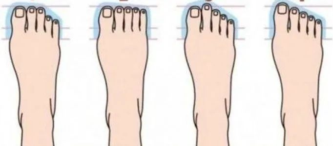 怎么选择合适的羽毛球鞋,怎么判断自己适合什么羽毛球球鞋