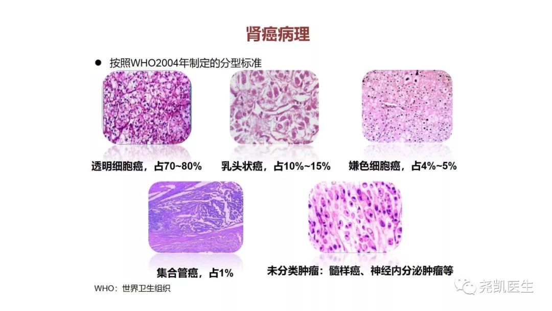 肾脏有包块饮食应注意什么,肾包块是什么