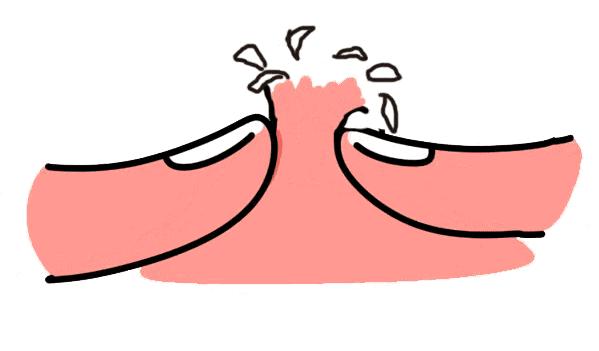 三天痘痘消失,三天不洗脸痘痘没了