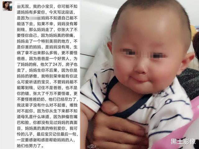 美女为生娃导致面部畸形,流浪街头自救:想活久一点,陪儿子长大