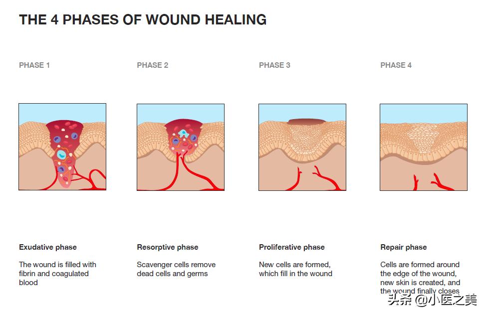 烫伤疤痕增生很硬很痒用什么药,烫伤疤痕增生怎么治疗最好