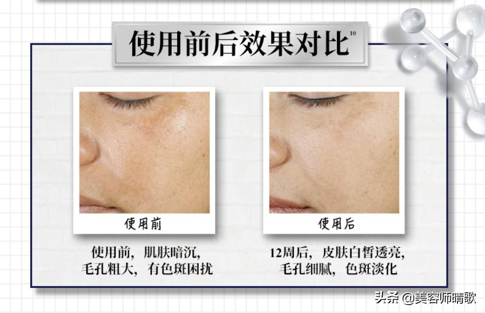 淡斑小白瓶精华二代,小白瓶淡斑精华光感和水感区别