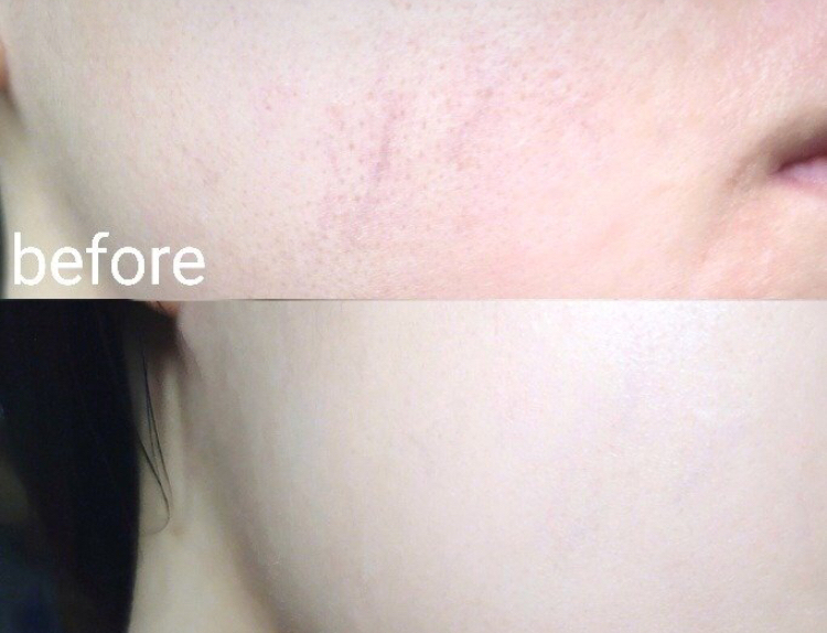 张馨予用的是什么眼霜,张馨予美致颜眼部精华乳