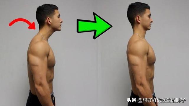 真相脖子后面的富贵包到底是什么,脖子上面的包是富贵包吗