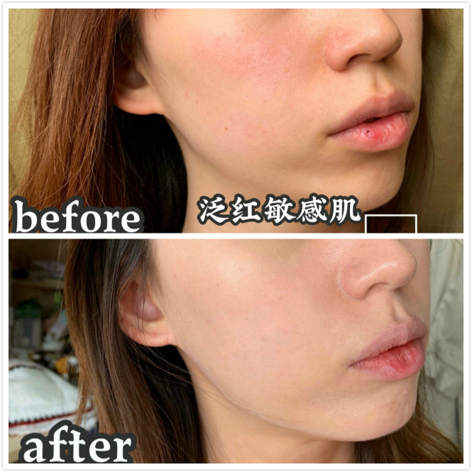 敏感肌适合用什么气垫推荐6款好用的适合敏感肌用的气垫