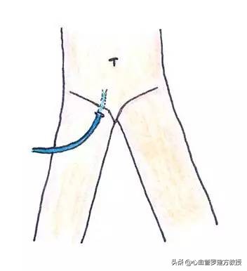 发生心律不齐，怎么样才能恢复正常？#原创首发##青云计划#