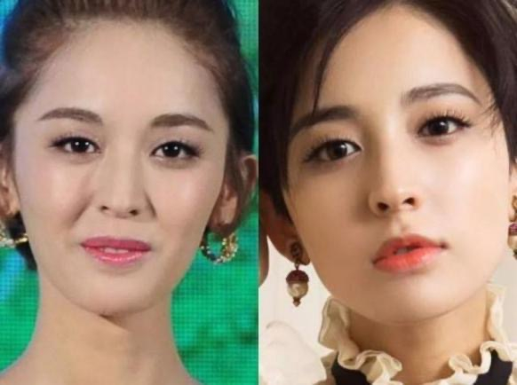 杨紫近照曝光无修图法令纹很深,杨紫面部填充法令纹