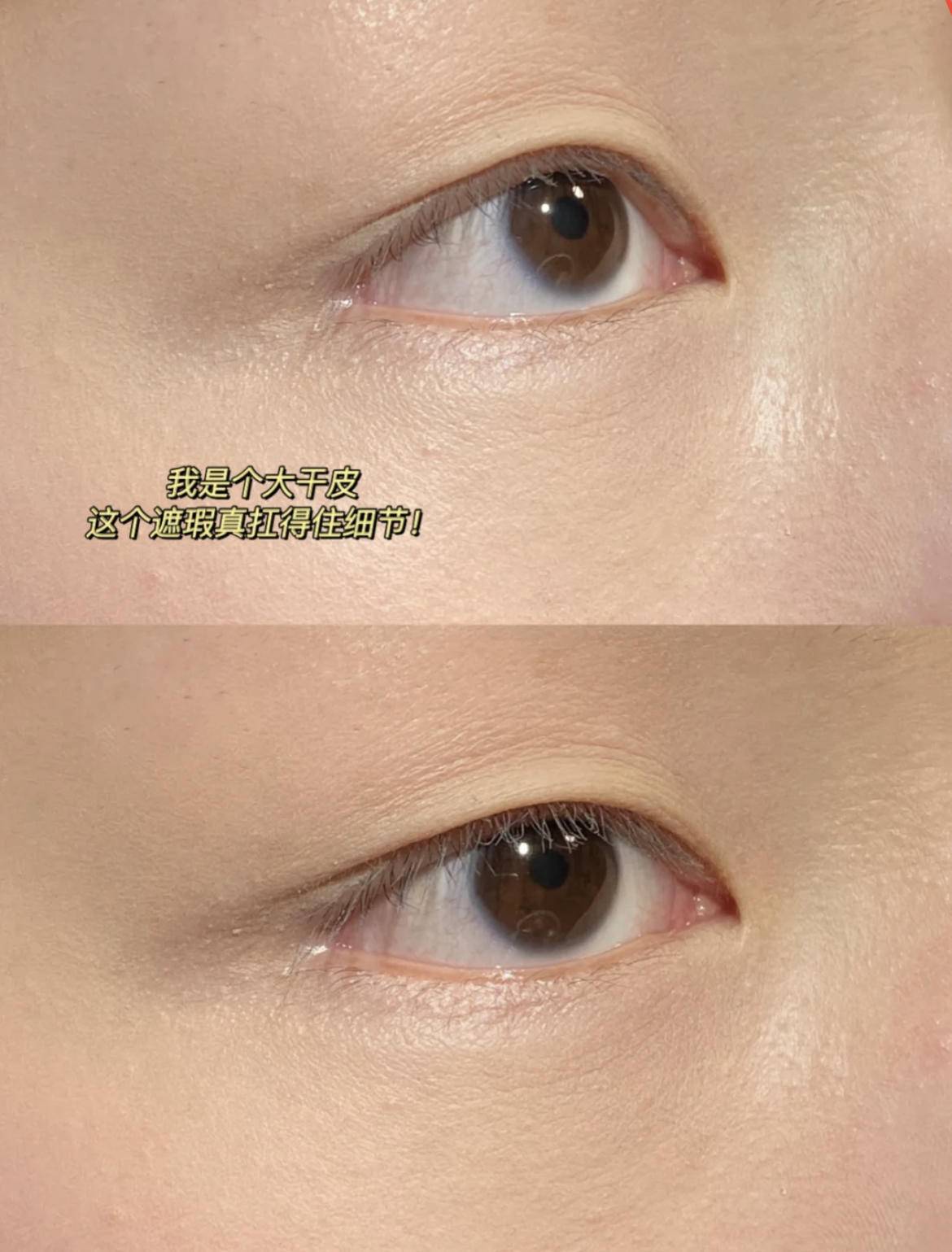 熬夜引起的泪沟黑眼圈能消失么,万年黑眼圈眼袋泪沟怎么遮瑕