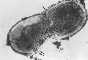 科普向——战“疫”进行时！三分钟看完世界病毒发现史！