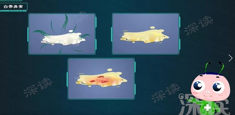 下腹痛白带正常会是盆腔炎吗,盆腔炎小腹疼白带多