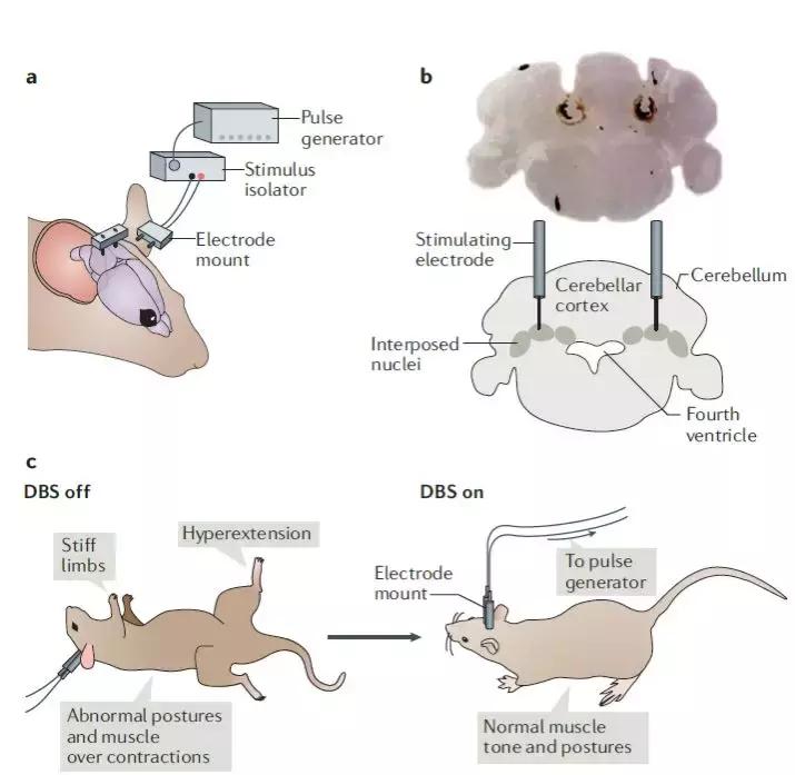 小脑的结构与功能,小脑的功能医学基础知识