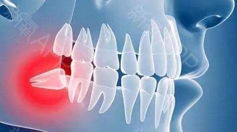 周冬雨拔智齿脸肿成了表情包,周冬雨拔智齿前后脸型对比图