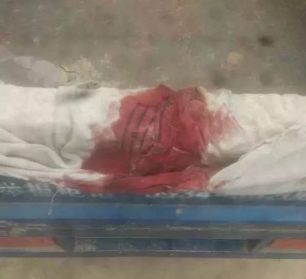 女孩被打出血官方通报,甘肃女孩被打身亡