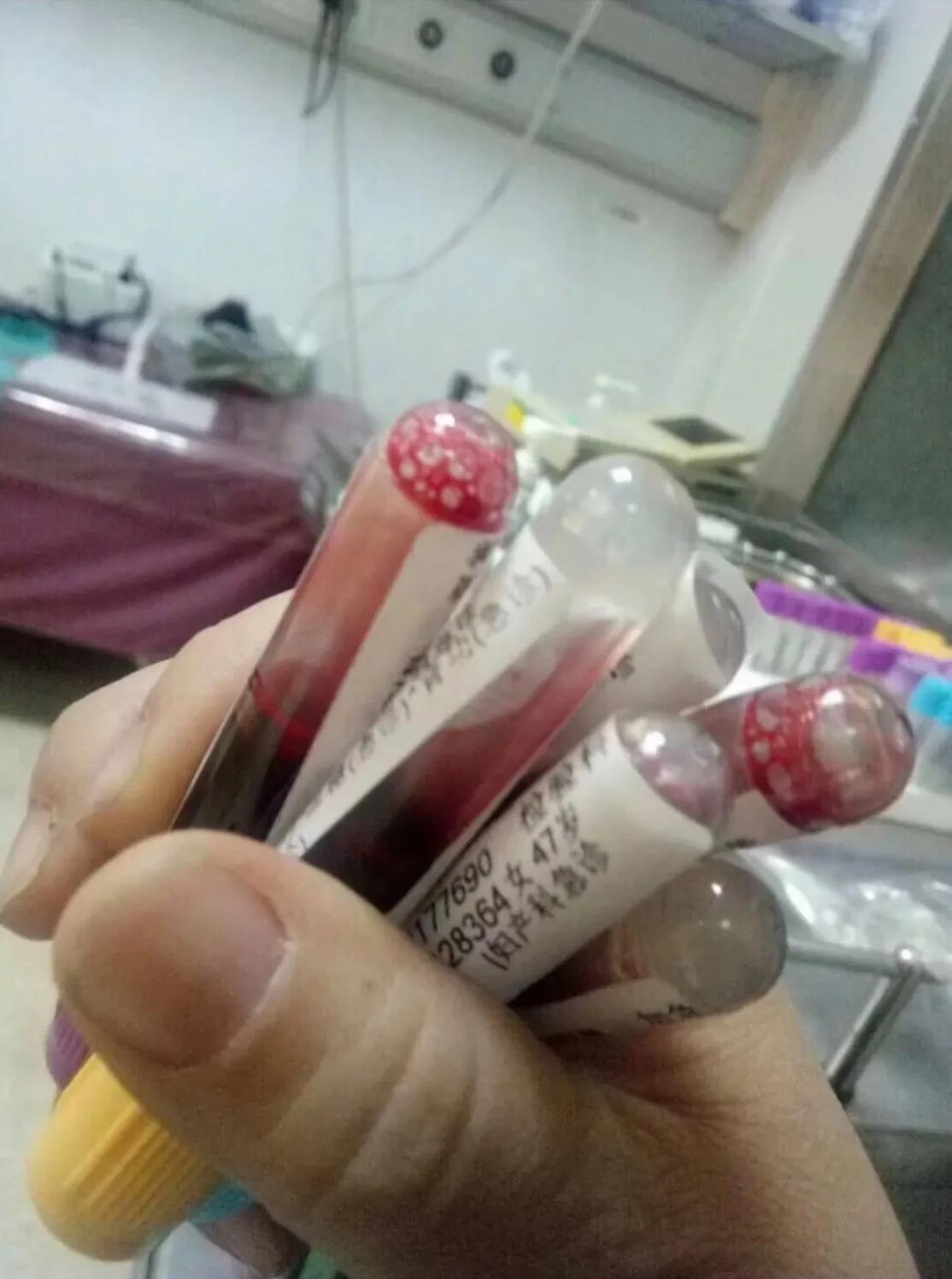 年轻人抗癌日记,抗癌日记闪光的金子今天视频