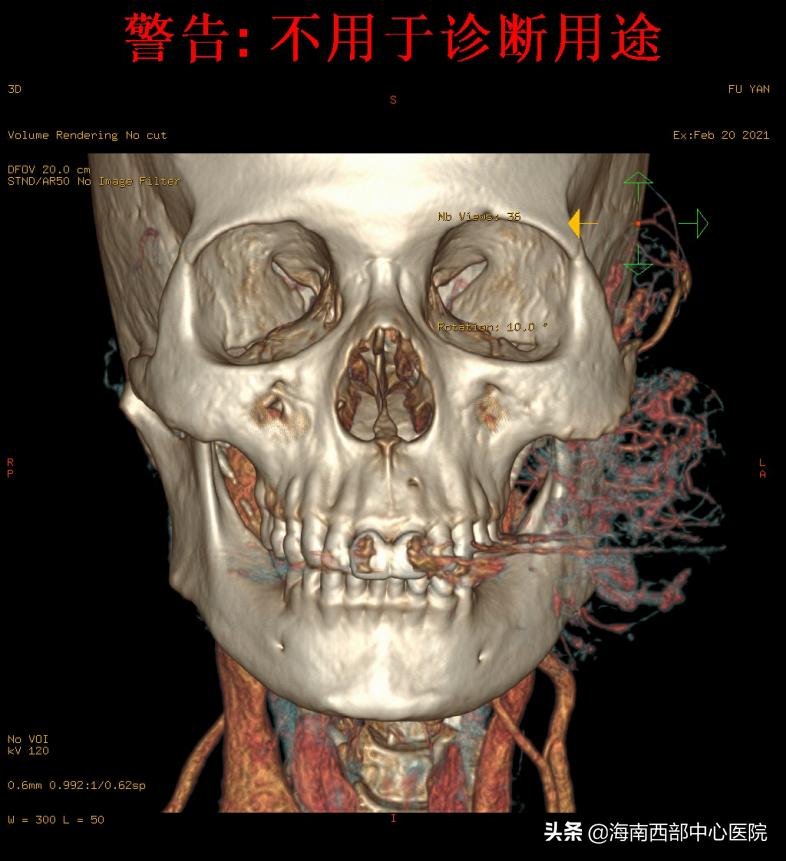 海南西部中心医院进展,海南西部中心医院三期进展