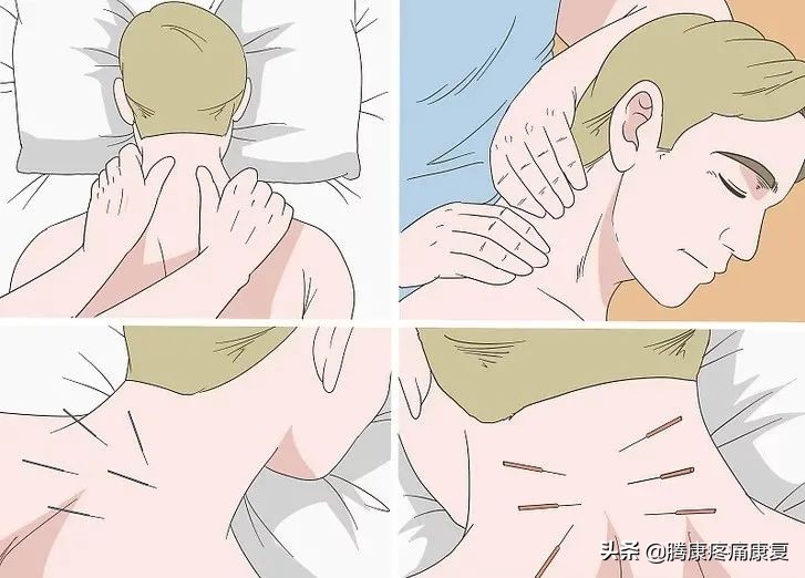 紧张性头痛如何治疗视频,紧张性头痛的临床表现及诊断