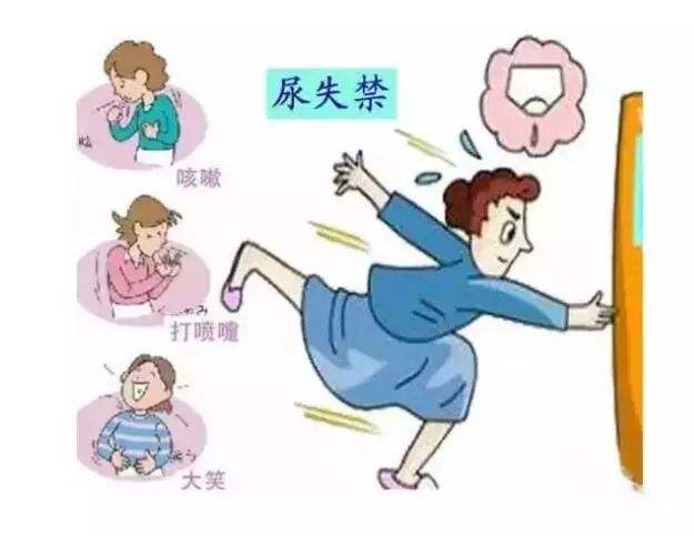 产后子宫脱垂能通过盆底肌修复,产后尿潴留的预防