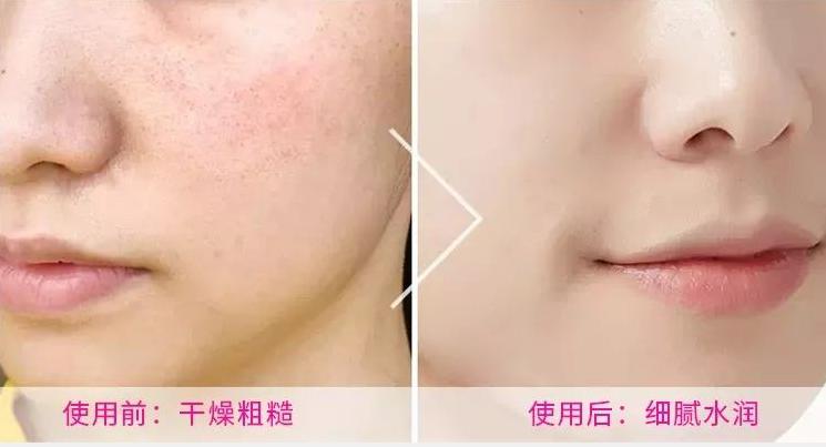 玻尿酸烟酰胺精华水正品,玻尿酸精华液爆款榜