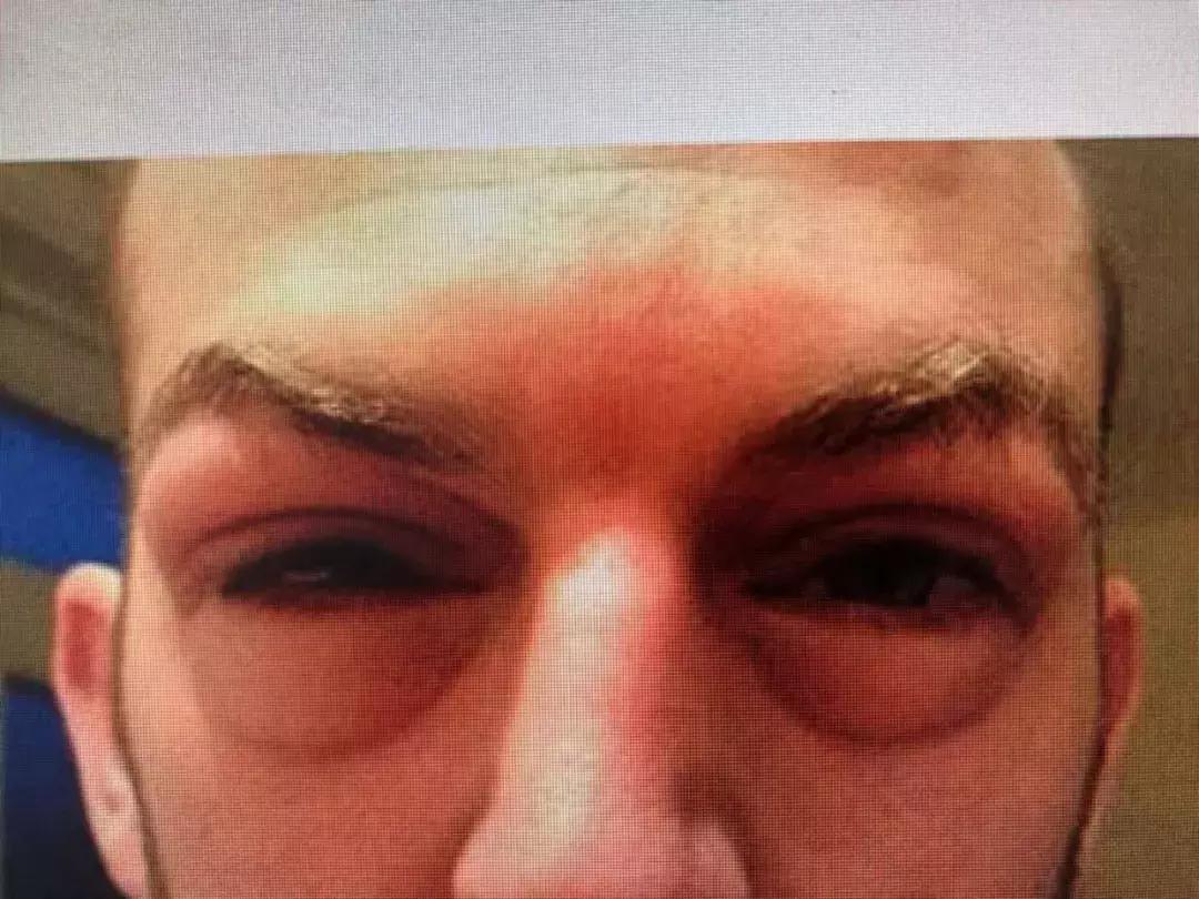 有卧蚕但是笑得不好看,有卧蚕好看还是不好看