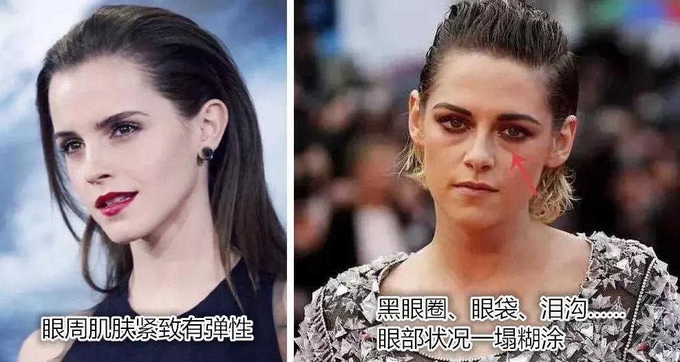 眼霜到底有没有用啊,眼霜里面有什么成分不能用