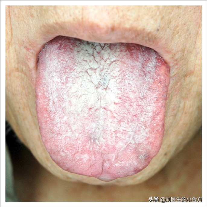 舌象图解大全中医舌诊,最全中医舌诊图谱来了