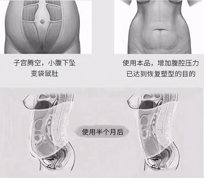 网红爆款束腹带,网红推荐的产后收腹带
