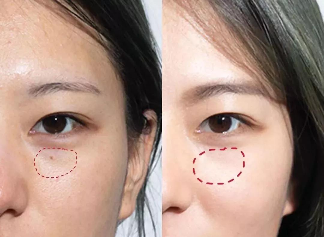 毛戈平遮瑕手法李佳琦 (毛戈平遮瑕李佳琦)