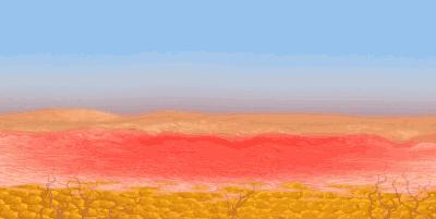 痘痘肌女孩必看,油痘肌必须知道的