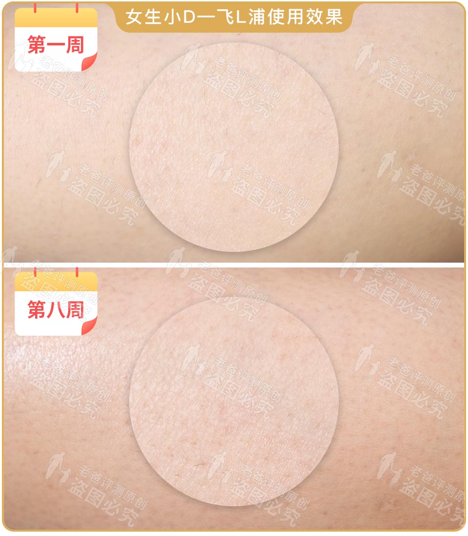 最真实的脱毛仪,bequeen脱毛仪实测