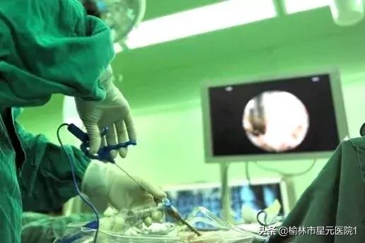 榆林佳县治疗腰椎间盘突出,榆林腰椎间盘突出最有效治疗