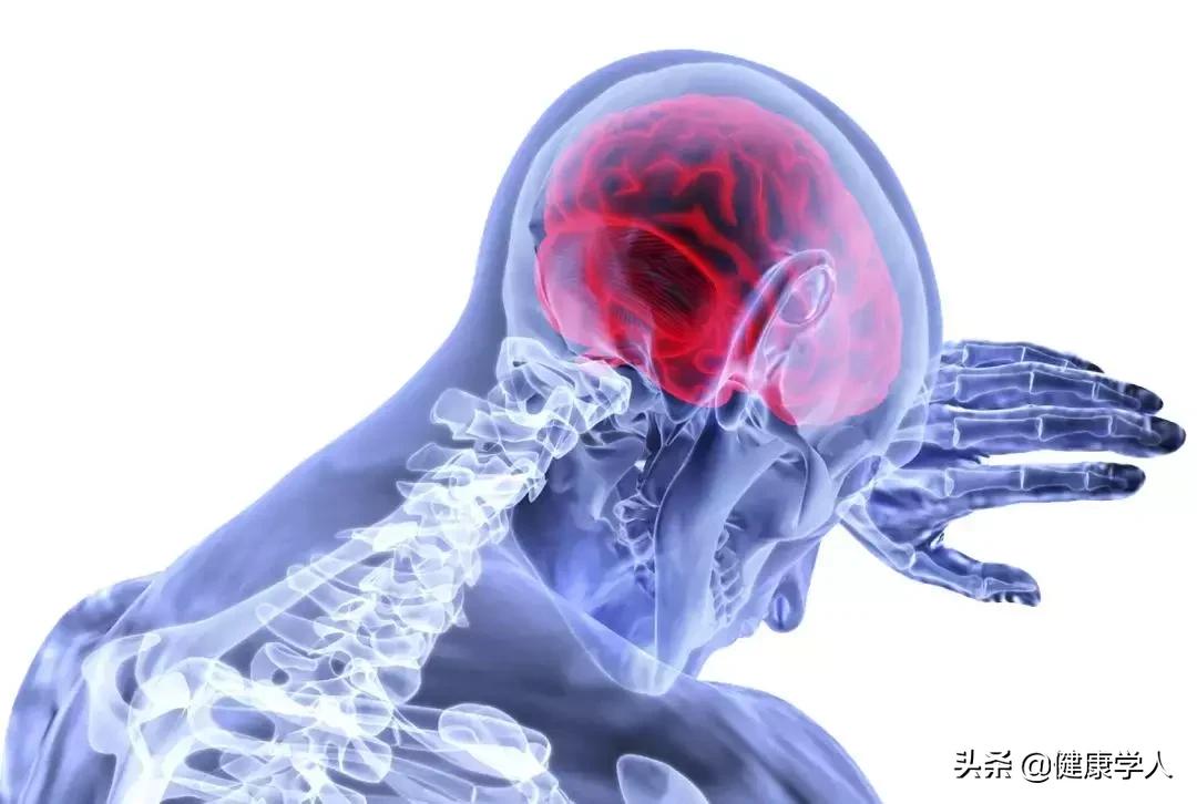 让人闻风丧胆的“脑梗死”究竟是怎么回事？