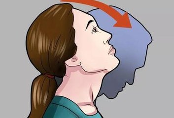 落枕了不能低头一招搞定,落枕了要不要动脖子