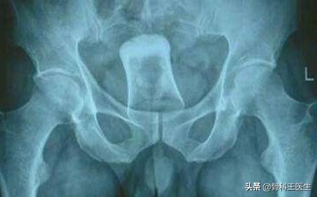 医院取出的异物怎么处理,医生都从患者体内取出过什么异物