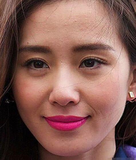 毛孔粗大怎么办最有效收缩毛孔,毛孔粗大收缩毛孔最有效方法实测